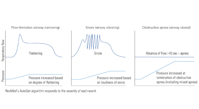 Autoset Technology Graph.gif