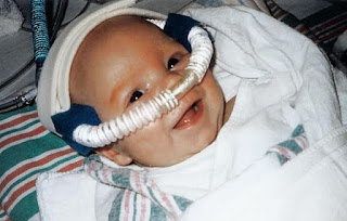 CPAP Machine For Newborns.jpg